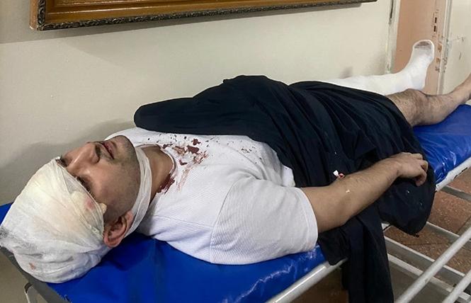 Uzbek activist and LGBTQ ally Miraziz Bazarov is shown on a hospital bed after being severely beaten outside his home in Tashkent March 28 Photo: Courtesy Pink News