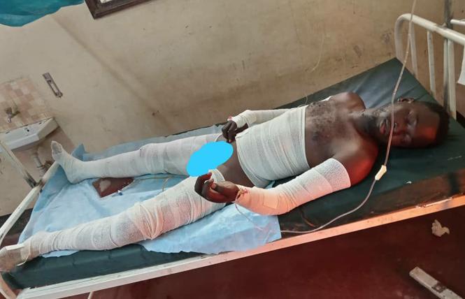 Chriton Atuhwera, a gay refugee from Uganda, died from his burn wounds April 12. His death came nearly a month after Block 13 at Camp Kakuma, Kenya's largest refugee camp, was burned in the middle of the night by an unknown suspect throwing petrol bombs on the compound. Photo: Courtesy Block 13 LGBTQI refugee activists at Camp Kakuma, Kenya/Facebook 