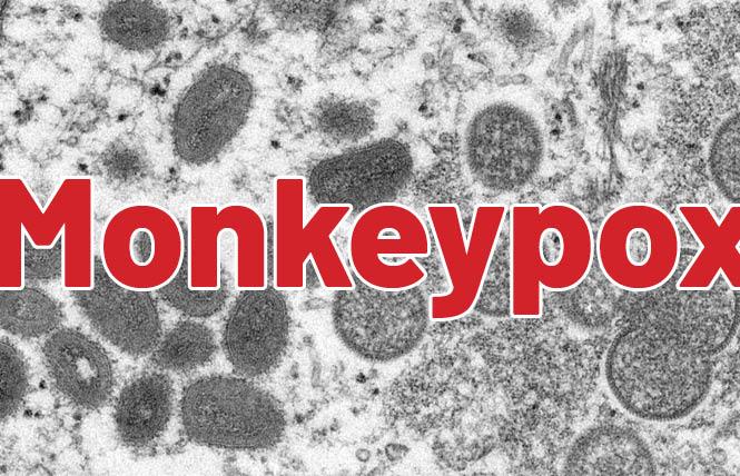 The oval-shaped monkeypox virus, left, is shown in a 2003 electron microscope image made available by the U.S. Centers for Disease Control and Prevention. Photo: Courtesy CDC library