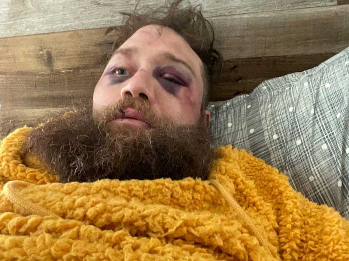 Isaac Featherston shared this photo that was taken when he got back from the hospital the morning after he was attacked. Photo: Courtesy Isaac Featherston