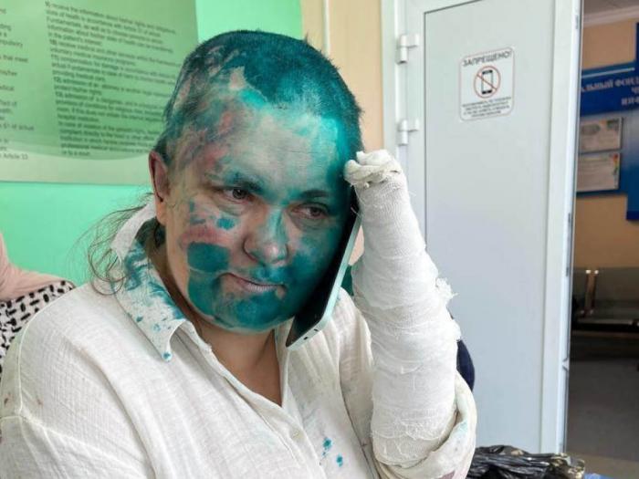 Award-winning Russian investigative journalist Elena Milashina is shown bandaged in a Grozny hospital July 4 after being brutally attacked by masked assailants. Photo: Courtesy of Committee Against Torture