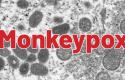 Monkeypox outbreak prompts alert for gay, bi men